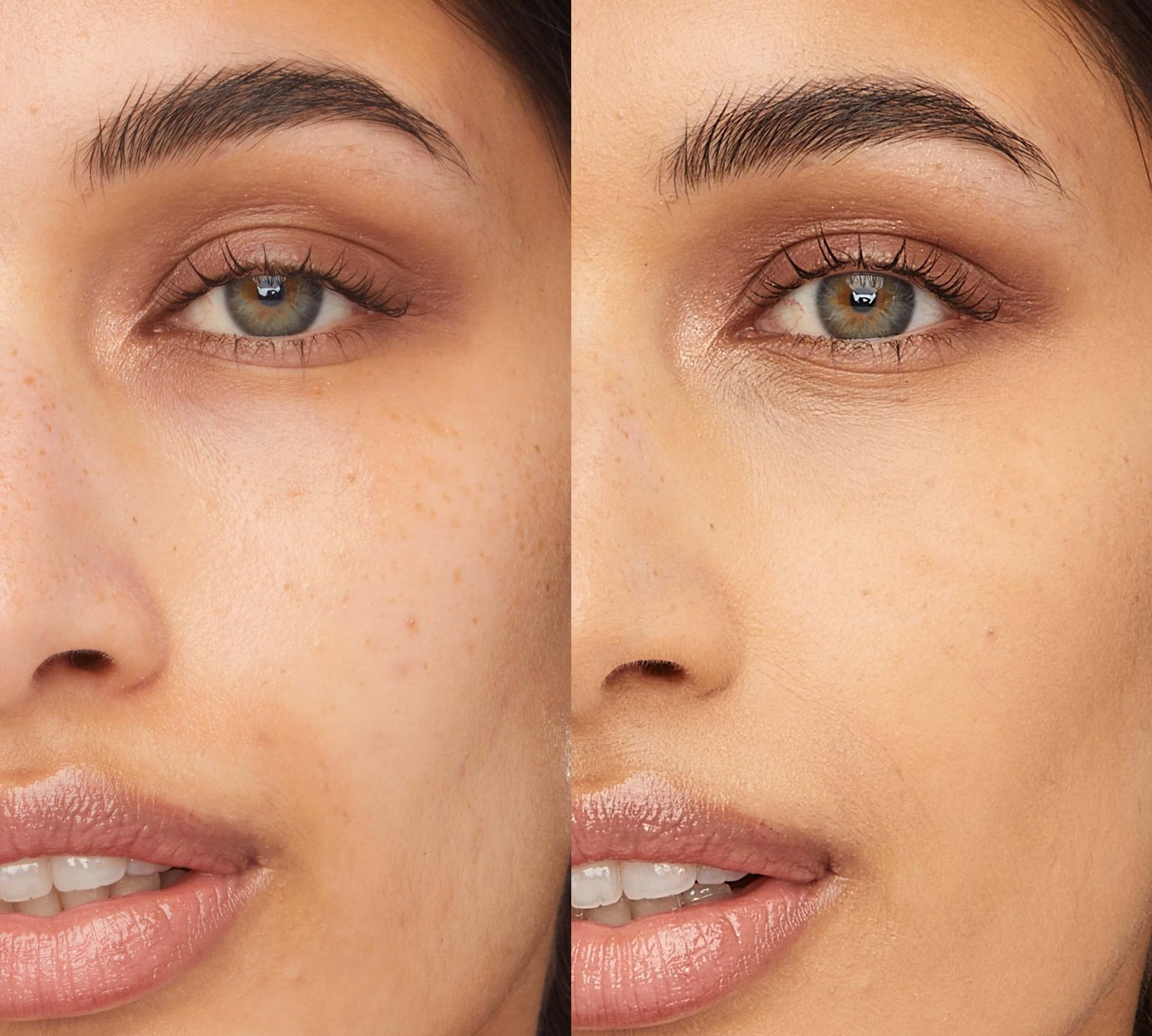 perfil de resalte antes y después